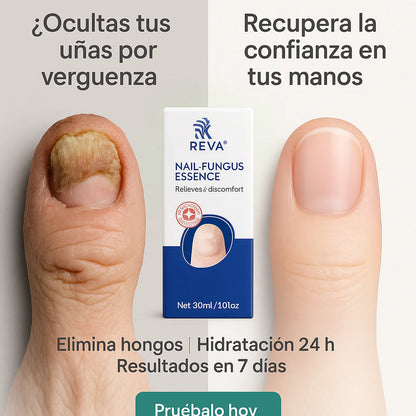 NAIL FUNGUS ESSENCE
