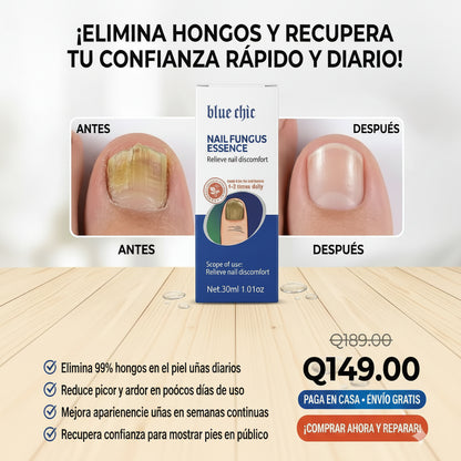 NAIL FUNGUS ESSENCE